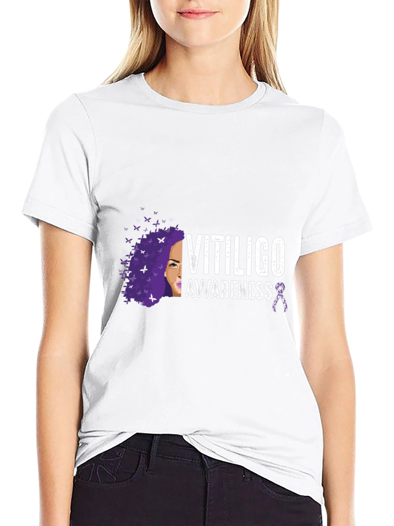 Vitiligo Awareness T-Shirt