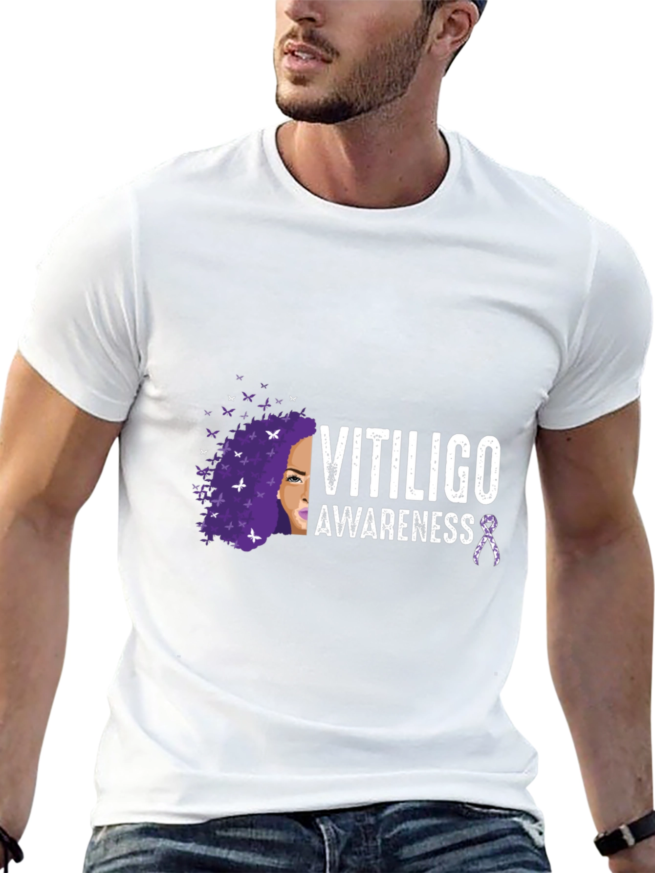 Vitiligo Awareness T-Shirt