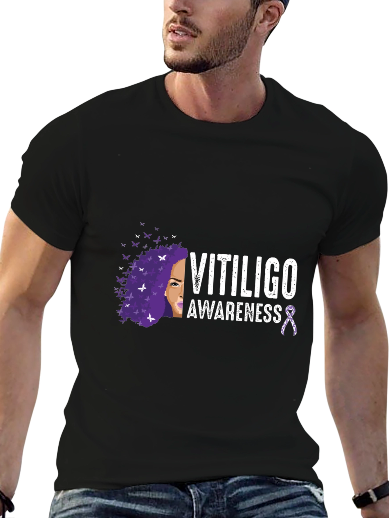 Vitiligo Awareness T-Shirt